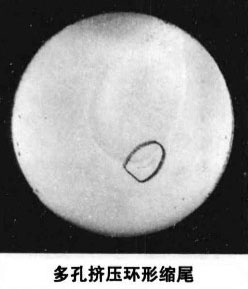 环形缩尾缺陷